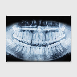 Холст прямоугольный Зубной Рентген, цвет: 3D-принт — фото 2