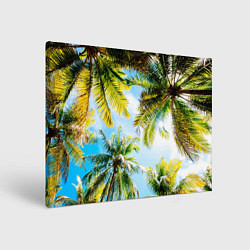 Холст прямоугольный Пальмы под солнцем, цвет: 3D-принт