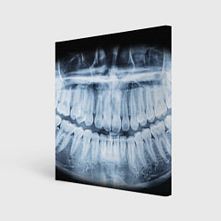 Картина квадратная Зубной Рентген