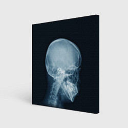 Холст квадратный Рентген головы, цвет: 3D-принт