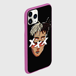 Чехол iPhone 11 Pro матовый XXXTentacion Head, цвет: 3D-фиолетовый — фото 2