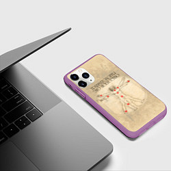Чехол iPhone 11 Pro матовый Травматология как искусство, цвет: 3D-фиолетовый — фото 2
