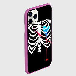Чехол iPhone 11 Pro матовый UNDERTALE, цвет: 3D-фиолетовый — фото 2