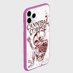 Чехол iPhone 11 Pro матовый Cannibal Corpse, цвет: 3D-фиолетовый — фото 2