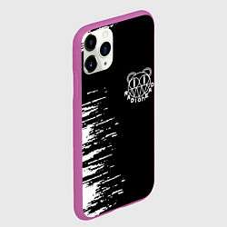 Чехол iPhone 11 Pro матовый Radiohead, цвет: 3D-фиолетовый — фото 2