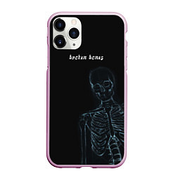 Чехол iPhone 11 Pro матовый Broken bones, цвет: 3D-розовый