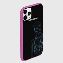 Чехол iPhone 11 Pro матовый Broken bones, цвет: 3D-фиолетовый — фото 2