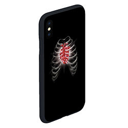 Чехол iPhone XS Max матовый Грудная клетка с сердцем кристаллом, цвет: 3D-черный — фото 2